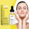 OUHOE Face Serum Moisturizes Facial Skin With Moisture Lock Hydrating Vitamin B3 Serum